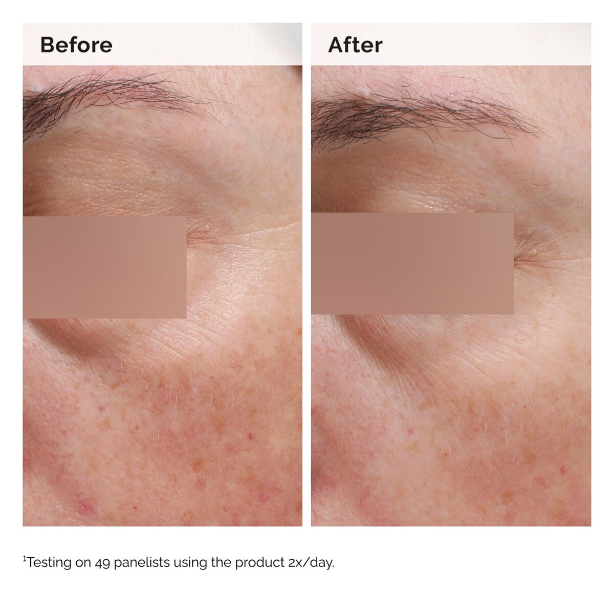 niacinamide-5-face-and-body-emulsion-e0 2024-08-23-ORD-Nia-5pct-Face-Body-B-A-Elasticity-Global-02-1x1.jpg