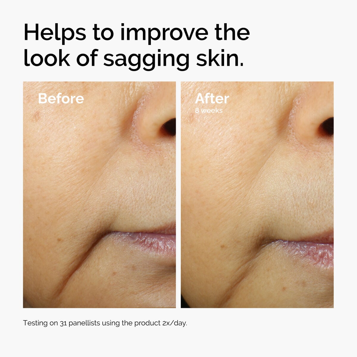 caffeine-3-escin-1-face-serum-c2 ord-caffeine-3pct-escin-1pct-face-serum-before-after-sagging.jpg