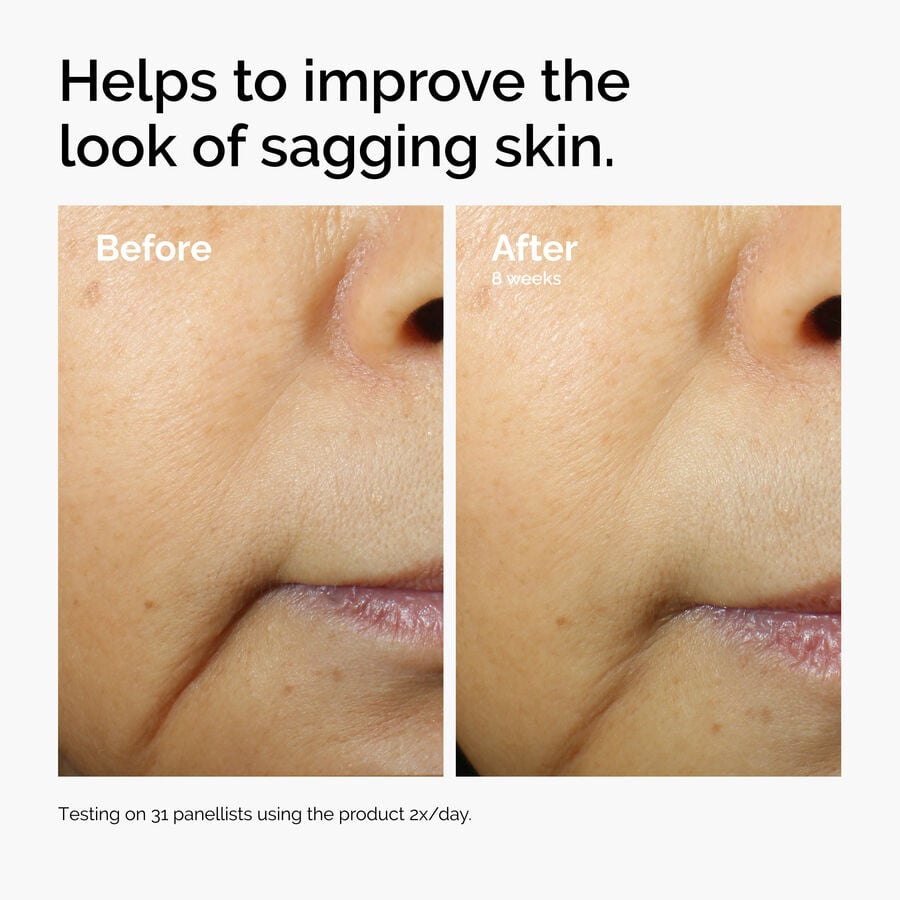 caffeine-3-escin-1-face-serum-c2 ord-caffeine-3pct-escin-1pct-face-serum-before-after-sagging.jpg