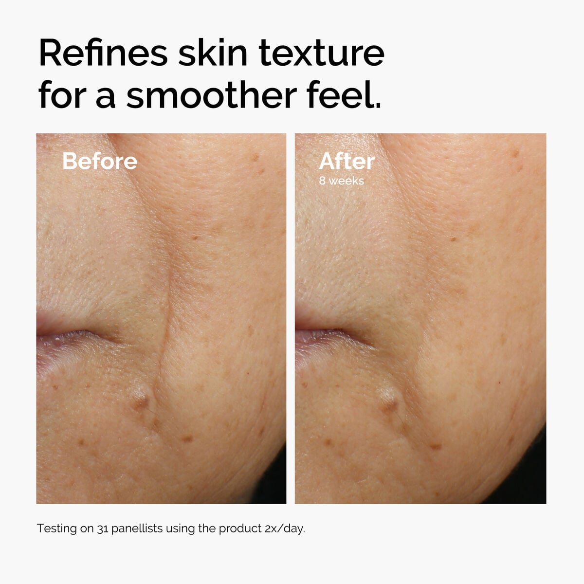 caffeine-3-escin-1-face-serum-c2 ord-caffeine-3pct-escin-1pct-face-serum-before-after-texture.jpg