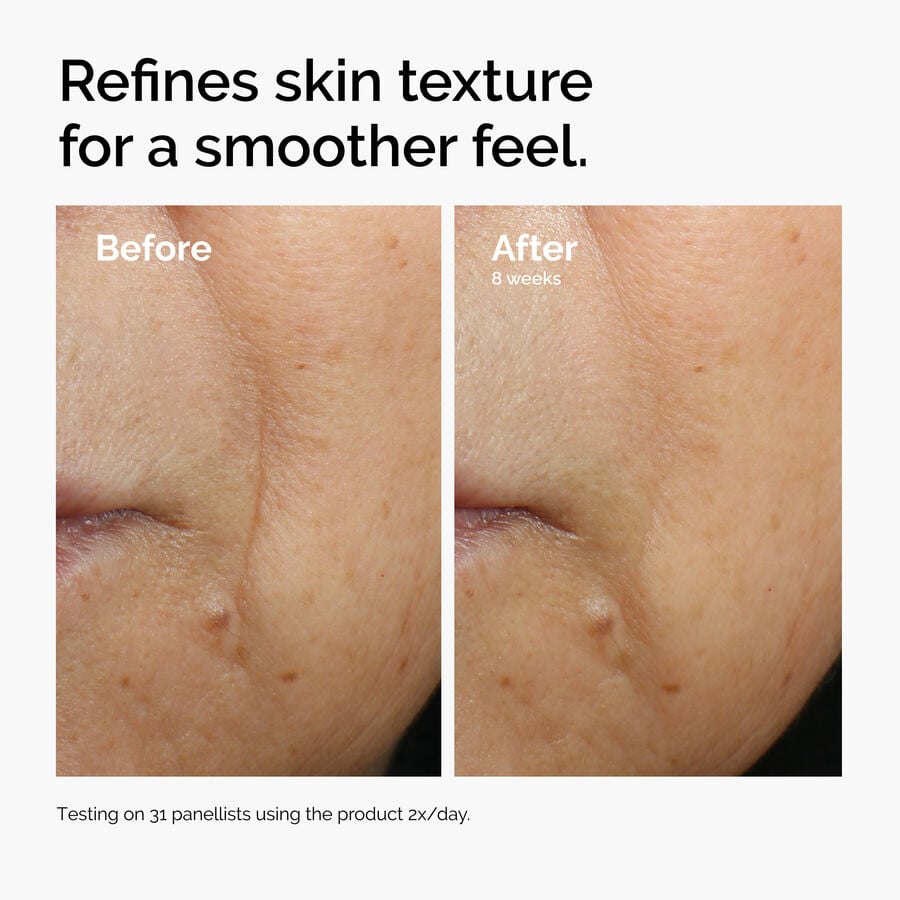 caffeine-3-escin-1-face-serum-c2 ord-caffeine-3pct-escin-1pct-face-serum-before-after-texture.jpg