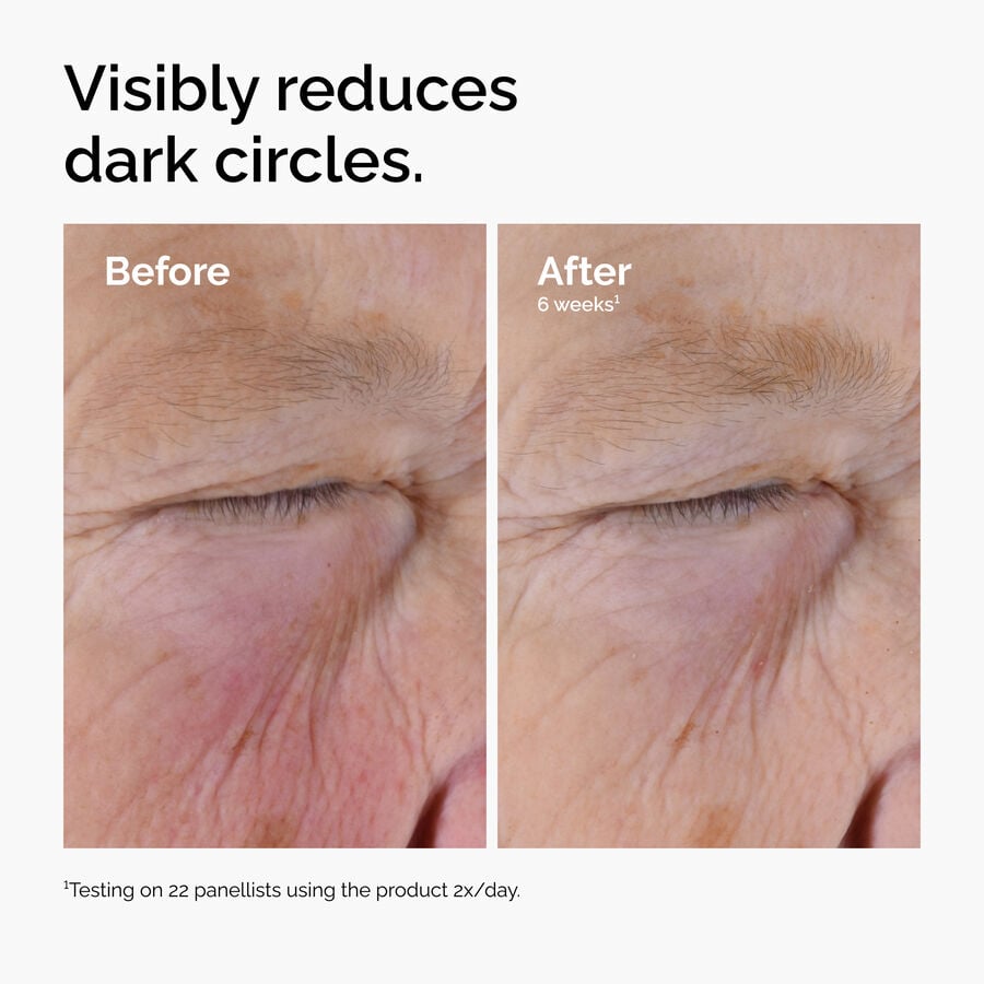 caffeine-solution-5-egcg-eye-serum-y8 ord-caffeine-solution-egcg-dark-circles-before-after.jpg