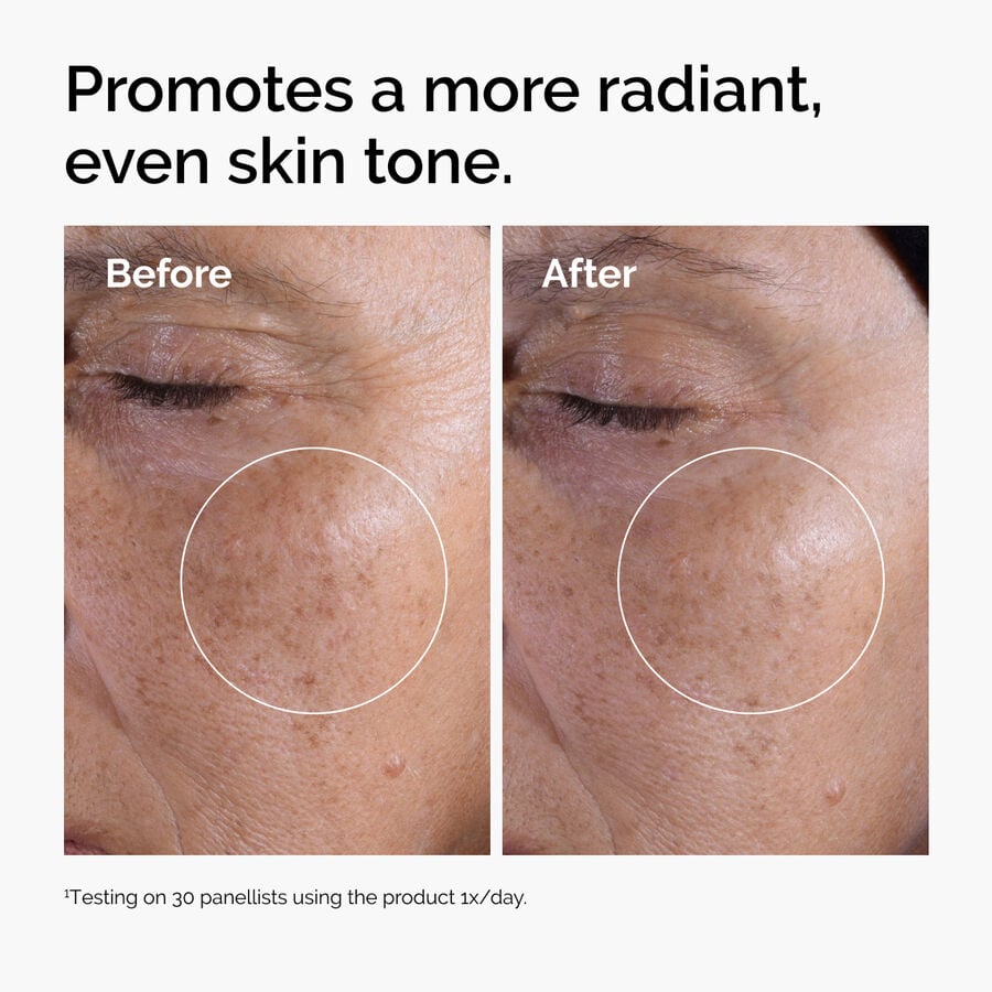 glycolic-acid-7-exfoliating-toner-t7 ord-glycolic-before-after-radiance.jpg