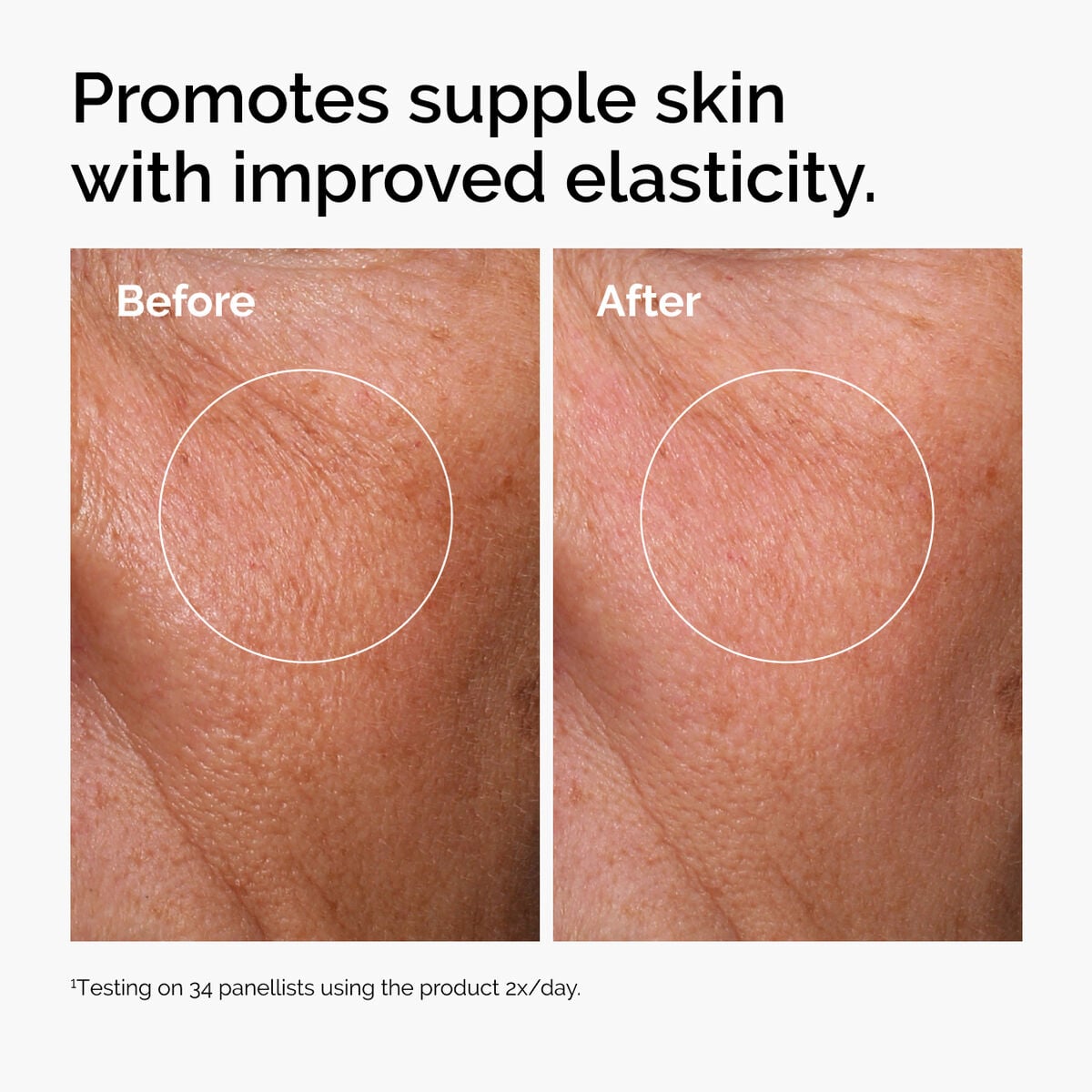 hyaluronic-acid-2-b5-with-ceramides-w7 ord-hyaluronic-acid-2pct-b5-hydrating-serum-before-after-elasticity.jpg