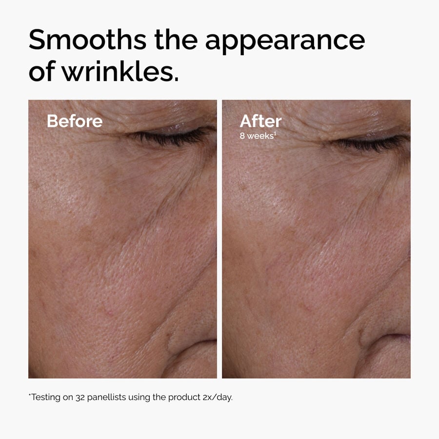 multi-peptide-ha-serum-u8 ord-multi-peptide-ha-serum-wrinkles-before-after.jpg