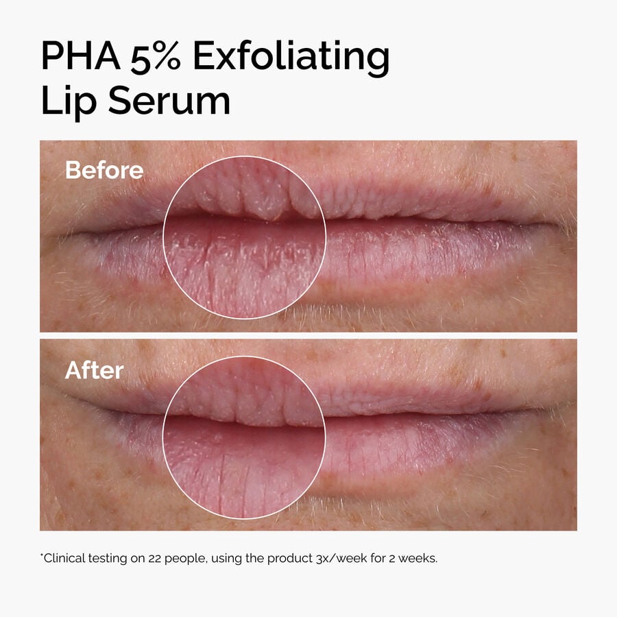 pha-5-exfoliating-lip-serum-v1 ord-pha-5pct-lip-exfoliating-serum-before-after.jpg