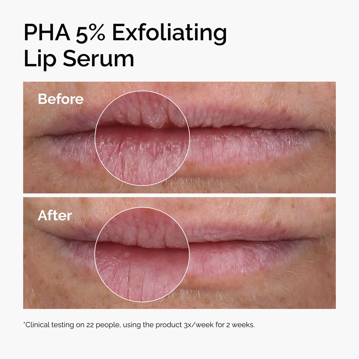 pha-5-exfoliating-lip-serum-v1 ord-pha-5pct-lip-exfoliating-serum-before-after.jpg